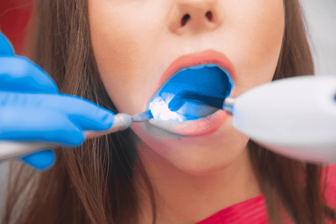 Advanced Restorative Dentistry Techniques