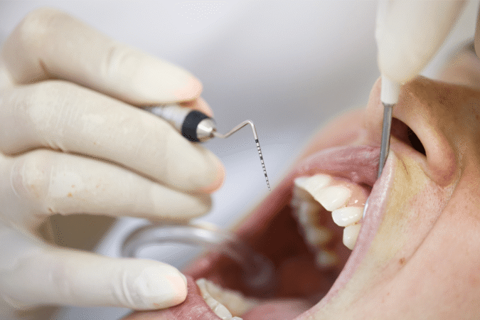 Periodontal Therapy and Surgical Techniques